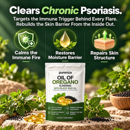PURENZA OREGANO & BLACK SEED OIL — SOOTHES SKIN & SCALP FROM THE INSIDE OUT